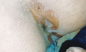 Cunning time painfull anal fuck with indian hot bhabhi